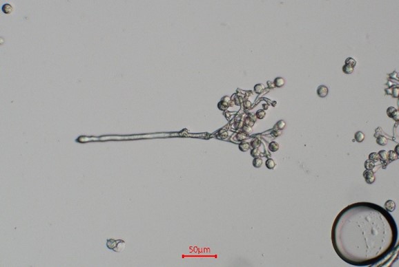 DIC microscopy